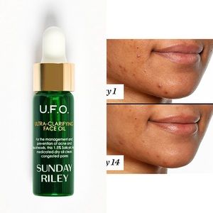 ULTRA-CLARIFYING ACNE TREATMENT FACE OIL